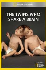 Watch National Geographic The Twins Who Share A Brain 0123movies