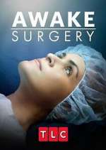 Watch Awake Surgery 0123movies